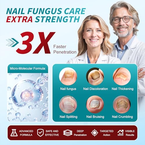 Nail Fungus Pen : Toenail Fungus Treatment Extra Strength - Antifungal Nail Repair for Damaged, Yellow, Thick Toenails - 25% Undecylenic Acid & Tea Tree Oil Mild and Non-Irritating 3pieces
