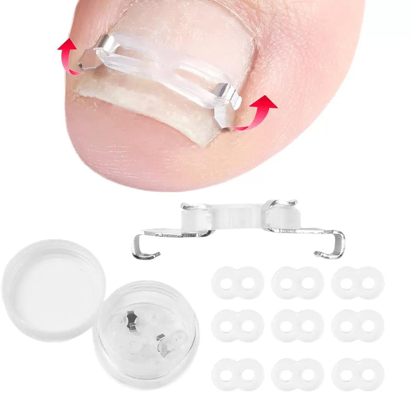 Ingrown Toenail Corrector Kit for Men Women - Ingrown Nail Tool - 2 Stainless Steel Clips- Curved Nail Strips & Toe Pads for Embedded/Curled Nails