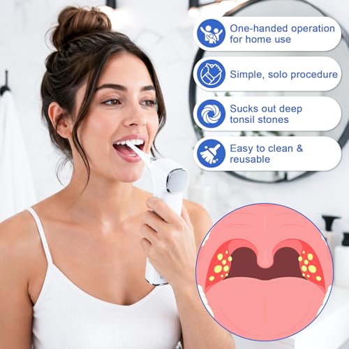 Tonsil Stone Remover, 12-in-1 Tonsil Stone Removal Kit with 5 Adjustable Suction Levels, Built-in LED Light, One-Touch Pause, 5X Magnifying Mirror, Electric Vacuum Suction Tool for Oral Care White