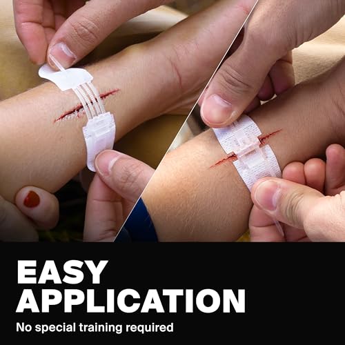 SurviveX Zip Stitch Wound Closures - No Stitches Needed, 3 Pieces 3 PCS