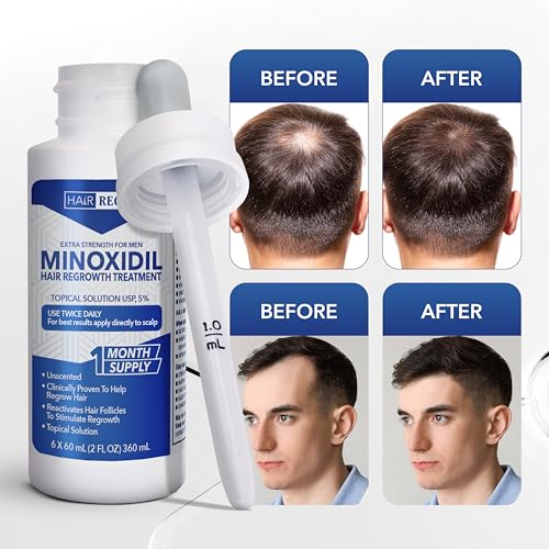 Hair Regen Liquid Minoxidil for Men 5% – Topical Solution for Regrowth