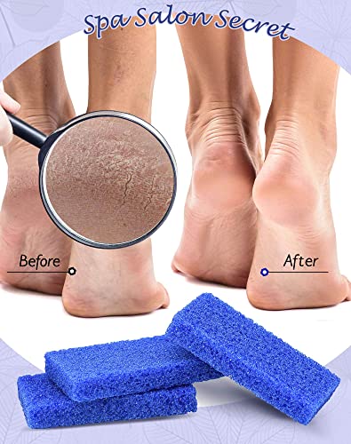 Maryton Disposable Pedicure Pumice Stone for Feet Scrubber, 40PCS Blue 40 Count (Pack of 1)