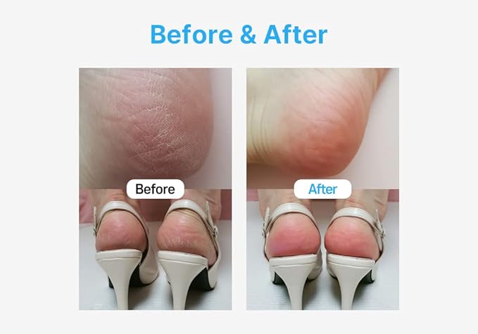 MADFORCOS Silky Coconut Oil Foot Mask, 16 ml, 5 Pieces, Foot Mask, Foot Mask Pack, Footpack, Foot Pack, Moisturizer, Foot Care - BeesActive Australia
