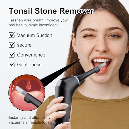 Electronic Tonsil Stone Remover with Camera, Tonsil Stone Removal Kit, 3 Suction Levels, Tonsil Stone Vacuum, Oral Care for Mouth Health, USB Rechargeable (Black)