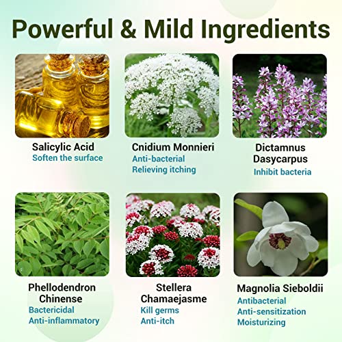 Psoriasis Cream, Maximum Strength Treatment Moisturizing Cream for Psoriasis, Dermatitis, Rash, Anti-Itch, Redness, Flaking, Scaling, Fast Acting Relief for Irritated, Dry Skin 1.76oz