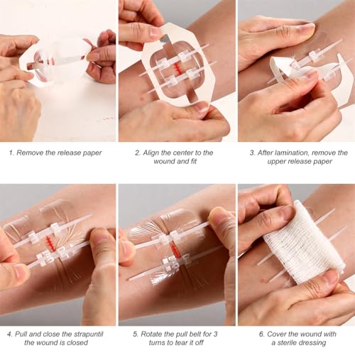 Emergency Wound Closure Strip 2PCS Wound Closure Kit Zip Stitch Wound Closure Device Laceration Closure Kit Wound Closure Glue Bandages Sutures to Close the Cut 6X7CM