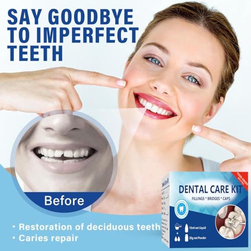 Tooth Repair Kit, Temporary Teeth Replacement Kit, Zinc Oxide Eugenol Cement Dental Kit for Broken Chipped Teeth, Missing Teeth, Crown Fillings & Bridges, Improving Smile 4 Pcs