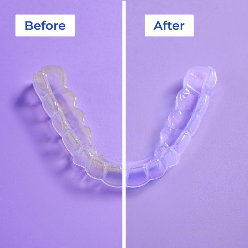 WATER DENT Retainer & Aligner Cleaner – Liquid Soak for Clear Aligners, Retainers, Dentures, Mouth Guards & Night Guards, Ultrasonic Compatible, Alcohol Free, Mint, 16.9 fl oz, Made in USA 16.9 Fl Oz (Pack of 1)