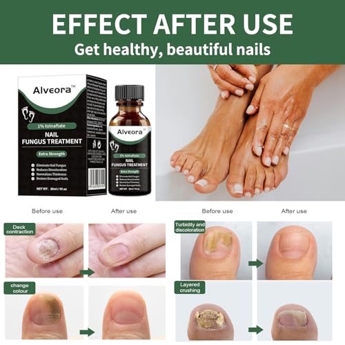 30ml Toenail Fungus Treatment Extra Strength Repair Foot Nail Fast Acting