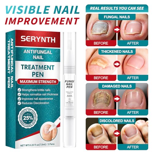 Nail Fungus Pen : Toenail Fungus Treatment Extra Strength - Antifungal Nail Repair for Damaged, Yellow, Thick Toenails - 25% Undecylenic Acid & Tea Tree Oil Mild and Non-Irritating 3pieces