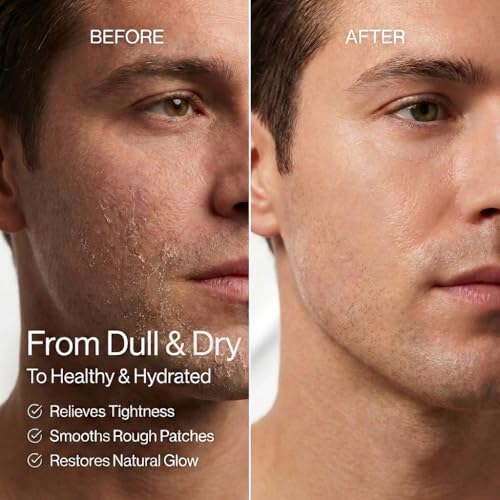 Anthony All-Purpose Facial Moisturizer – Men’s Hydrating Lotion for Dry Skin – Lightweight, Non-Comedogenic, Anti-Aging Formula – 3 Fl Oz 3 Fl Oz (Pack of 1)
