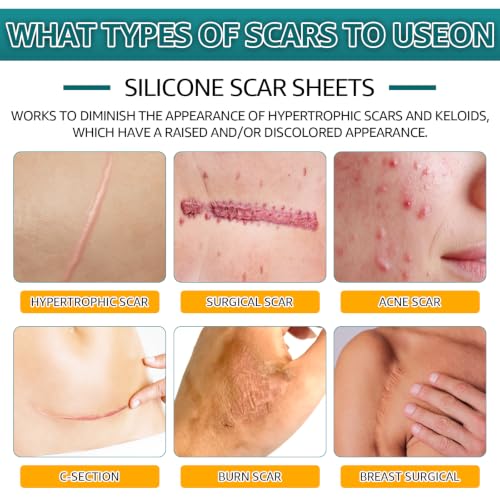 Silicone Scar Sheets, Silicone Scar Tape for Surgical, Hypertrophic, Keloid, C-Section, Burn, Old & New Scars, Reusable Scars Removal Sheets