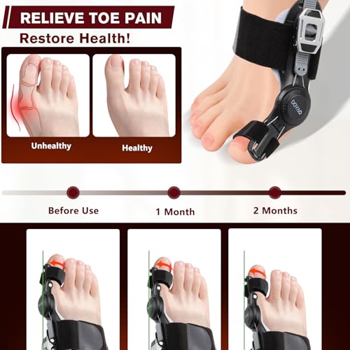 TUOB Bunion Corrector for Women & Men Big Toe, Toe Straightener Device with Adjustable Bunion Splint, Bulit in Silicone Bunion Pad Benefit for Pain Relief