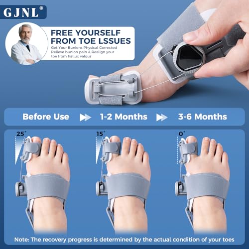 GJNL Bunion Corrector for Women & Men – Upgraded Adjustable Bunion Fix for Big Toe Separation Pain Relief, Bunion Splint Suitable for Left/Right Feet, Toes Alignment Hallux Valgus Correction (Grey) Grey