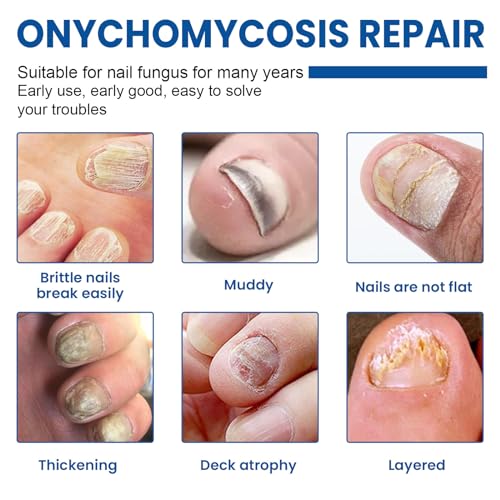 Fungal Nail Patches 60 Pcs,Upgraded Toe Nail Fungus Treatments 60 Count (Pack of 1)