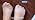 Toe Separators for Women - Podiatrist Recommended, Toe Spacers for Men, Breathable Bunion Corrector, Plantar Fasciitis(1 Pair)
