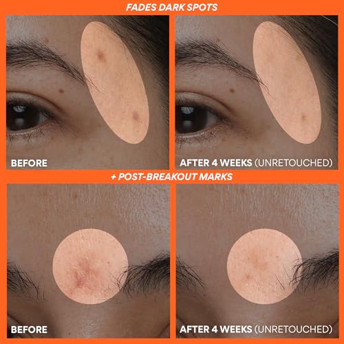 Innisfree Green Tea Enzyme Vitamin C Serum for Brightening Dark Spot Correction, Korean Face Serum for Radiant Glow 1.01 fl .oz. / 30ml: Full Size
