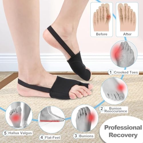 【ONE PARI】 Bunion Corrector