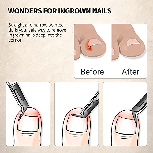 FERYES Toenail Clipper Straight Blade for Ingrown and Thick Nails - Stainless Steel and Sharp Pointed Tip Ingrown Nail Clipper – Wide Jaw Toe Nail Cutter Podiatry Tool Peacock Green 1 PCS Peacock Green Straight Blade