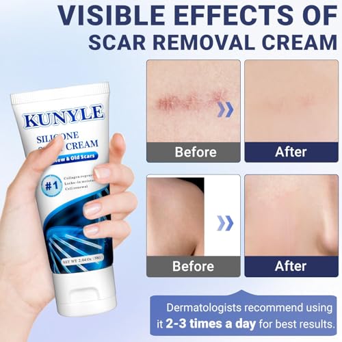 Scar Cream, Silicone Scar Gel, Advanced Scar Removal Cream for Surgical Scars, Stretch Marks Removal, Keloid Bump Removal, Old and New Scars 2.04 Oz (58g) Scar Cream 2.04 Ounce