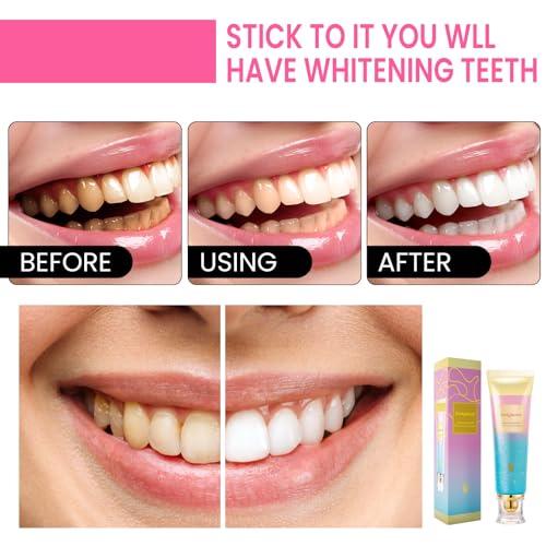 2 Pack BodyAccel Niacinamide Whitening Toothpaste, Triple Whitening Niacinamide Toothpaste, Brightens and Whitens Teeth, Natural Gentle, Fresh Breath 2pack