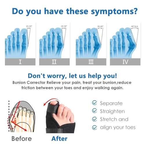 【2-Pack】 Bunion Corrector for Women & Men, 【2-Pack】