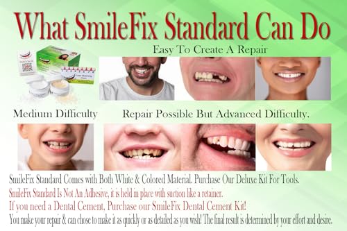 SmileFix Standard Dental Repair Kit - Color Matching Compound - For Missing Or Damaged Teeth - Fix Gaps, Broken Tooth, Spaces - Durable Repair - Fast & Easy - Confident Smiles