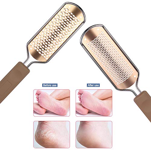 2 Pack Foot File Callus Remover Rasp Feet Scrubber for Dead Skin 2 Count (Pack of 1)
