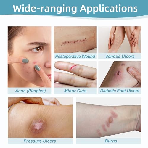 Hydrocolloid Bandages for Wound Care Dressing, 6.6ft Hydrocolloid Roll 2in x 6.6ft