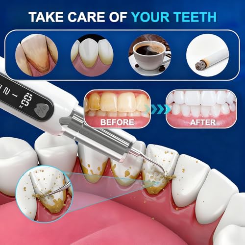 Plaque Remover for Teeth–5 Modes, LED, USB-C 4Tips Adult Teeth Cleaning Kit