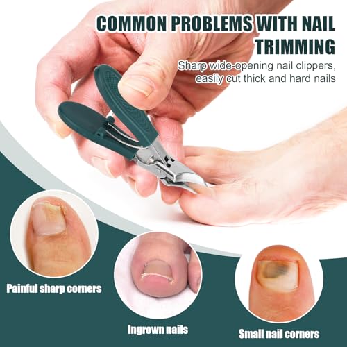 3pcs Ingrown Toenail Clippers Set, Professional Slanted Beveled Eagle Beak Curved Nail Clippers with File & Tear Tool for Thick Nails & Seniors (Green) Green, Silver