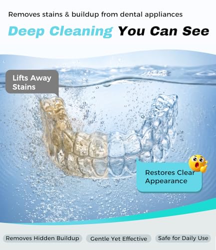 Ultrasonic Retainer Cleaner Machine, 45kHz Deep Gentle Dental Cleaning Pod with 304 Stainless Steel Tank, 4 Cleaning Modes for Aligners, Dentures, Mouth Guards, Night Guards, Toothbrush Heads White