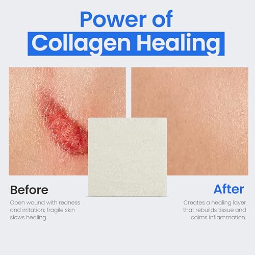 Collagen Dressing Pads - 2" x 2" 5 Count Collagen Pads for Wounds - Non-Adherent Collagen Dressing for Wound Care - Safe n' Simple Wound Care Supplies 2" x 2" - 5 Pads