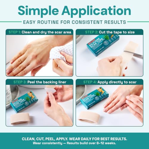 TargetControl Scar Tape for Surgical Scars, Silicone Sheets for Face, 1.2M Aloe Vera 1.2M