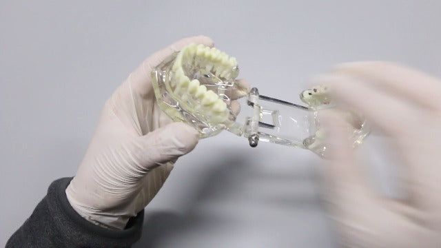 Dental Oral Typodont Model Implant Pathological Removable Teach Demo Visible Anatomy Demonstration Teaching Standard Size (Clear)