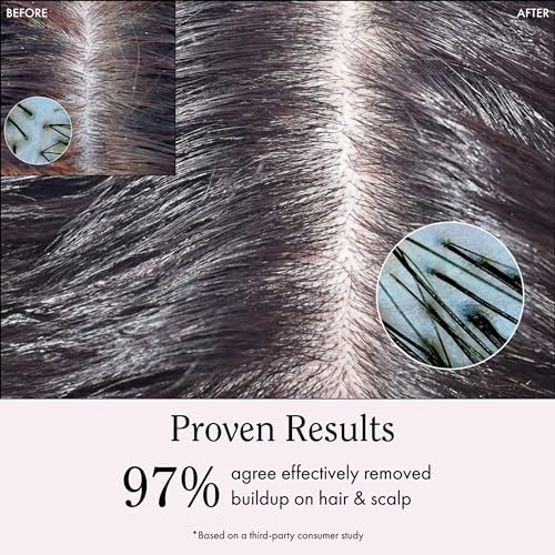Rizos Curls Apple Cider Vinegar Scalp & Hair Rinse, Clarifies to Remove Product Buildup, Balance Oils, Revive Hair & Scalp, Enhances Softness & Shine, 10 oz ACV Rinse