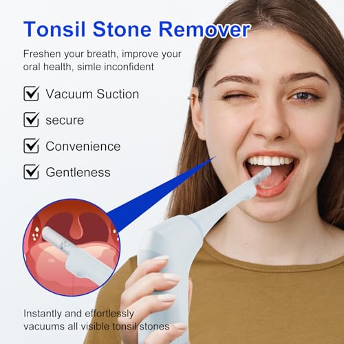 Electronic Tonsil Stone Remover with Camera, Tonsil Stone Removal Kit, 3 Suction Levels, Tonsil Stone Vacuum, Oral Care for Mouth Health, USB Rechargeable(Blue)