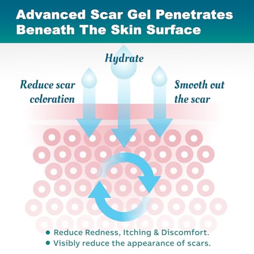 Scar Gel, Scar Cream, Advanced Scar Gel for Surgical Scars, Scar Cream for Surgical Scars, C-Section, Tummy Tuck, and Keloid 50g