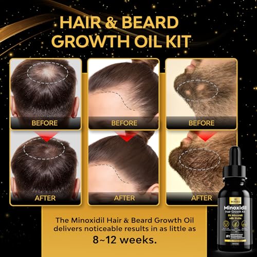 Beaueli Minoxidil Beard Growth Kit For Men and Women, Hair Loss and Hair Regrowth Treatments, Minoxidil 5%, Black 1 Count (Pack of 1)