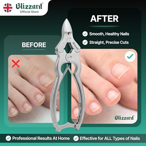 Blizzard Toe Nail Clippers for Thick Nails - Podiatrist Nail Nippers for Seniors - Heavy Duty Cantilever Toenail Clippers for Men - German Steel Podiatry Tool with Toenail File - 15cm Double Spring 15cm - Double Spring