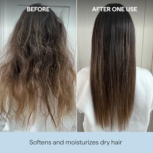 Briogeo Scalp Revival Rosemary Pre-Wash Oil | Moisturizing Scalp Treatment for Dry, Flaky, or Itchy Scalp | Strengthens Hair & Soothes Scalp | Vegan & Cruelty-Free 1 Fl Oz
