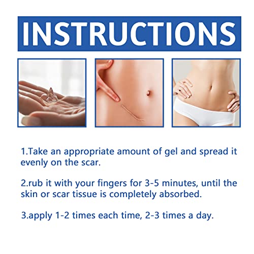 Silicone Scar Gel,Scar Cream,Scar Silicone Gel,Scar Removal Cream,Scar Gel,Scar Cream for Surgical Scars and Keloid Bump (1pcs)