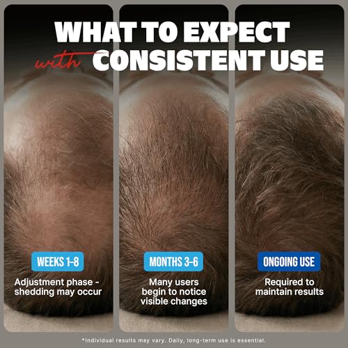 Minoxidil Liquid Extra Strength Hair Regrowth Treatment for Men, 5% Topical Solution, 6 Months Supply - Dropper Applicator and Bonus Free Instructional Guide Included