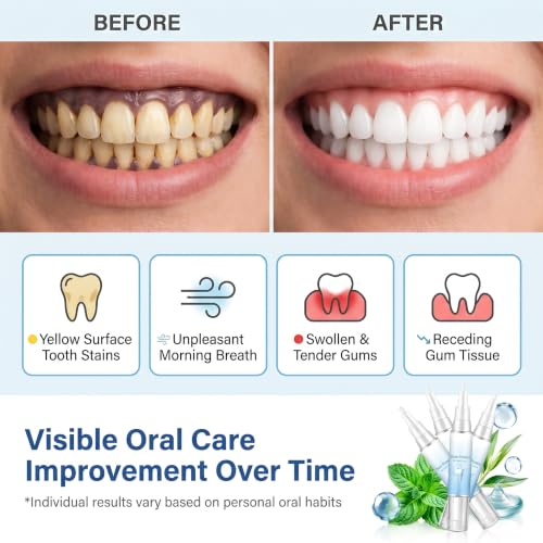 4Pcs Gum Repair Gel for Receding Gums & Oral Comfort, Gentle Dental Gel for Daily Gum Health & Enamel Care, Professional Gum Support Formula, Teeth Whitening Essence Pen