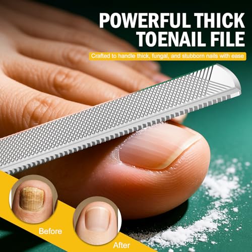 FVION Toenail File for Thick Nails and Toenail Lifter, 2pcs Stainless Steel Nail File and Ingrown Relief Set, Heavy Duty Metal Emery Board for Seniors, Men & Women Pedicure Tool (Green) Green Handle