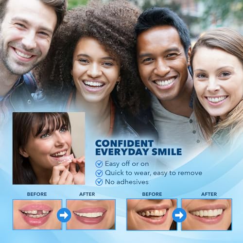 Imako Premium Cosmetic Uppers for Men and Women – Temporary Smile Makeover – 1 Pack Small, Natural White – Made in USA Small Natural White