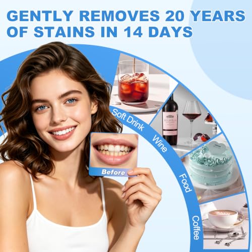 Teeth Whitening Kit with LED Light,Helps Remove Surface Stains 0.16 Ounce (Pack of 1)
