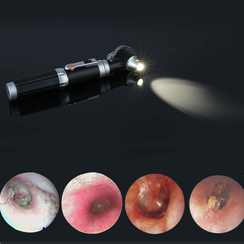 Mini Ear Otoscope, Bysameyee Magnification Diagnostic Ear Scope with LED Direct Illumination Light, Ear Healthy Tool for Doctors Nurses Adults Kids Baby Elder Pets Animals - BeesActive Australia