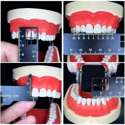 Professional Dental Precision Measuring Ruler, Black Stainless Steel Endodontic Scale Tool Instrument, Small Handheld Metric Scaling Measurements for Accurate Dental Assessment Care