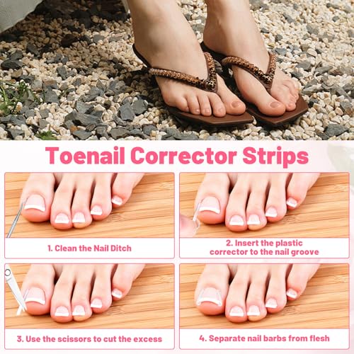 Ingrown Toenail Removal Kit Professional Ingrown Toenail Tool Kit with Ingrown Toenail Corrector, Corrector Patches, Toenail Clipper, Tools Stainless Steel Pedicure Tool Set